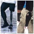 Prosthetic Cover | prosthetic foam covers | AFO | Drop Foot