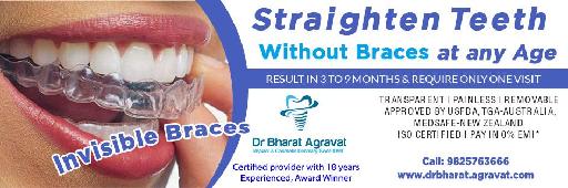Invisible clear braces for teeth cost, price, reviews, pros-cons, before-after from India』s leading best cosmetic dentist Bharat Agravat Ahmedabad Gujarat
