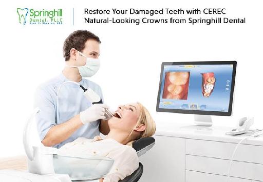 Restore Damaged Teeth with CEREC Natural-Looking Crowns