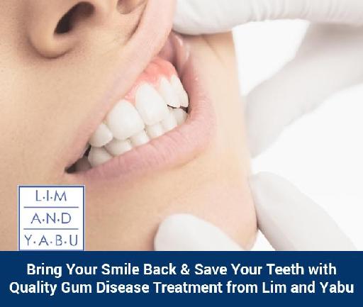 Bring Your Smile Back with Quality Gum Disease Treatment