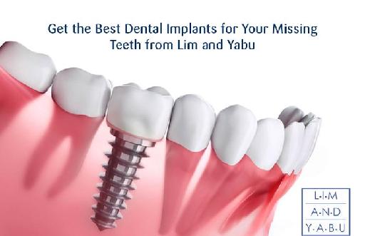 Get the Best Dental Implants for Your Missing Teeth