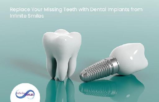 Replace Your Missing Teeth with Dental Implants