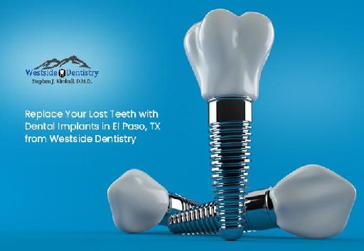 Replace Your Lost Teeth with Dental Implants in El Paso, TX from Westside Dentistry