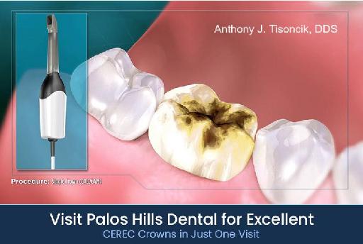 Visit Palos Hills Dental for CEREC Crowns in Just One Visit