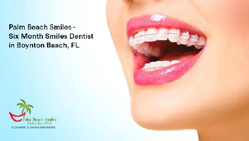 Six Month Smiles Dentist in Boynton Beach, FL