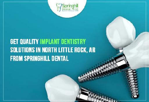 Get Quality Implant Dentistry Solutions