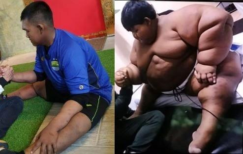 「世界最胖弟」3年成功減重108公斤